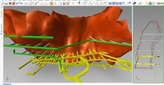 南非EGI 礦山開采系統